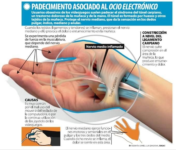 Dolor en la palma dela mano debajo del dedo gordo